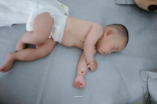 沛县六个月宝宝眼睛散光